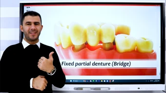 Fixed Prosthodontics | First Term - التجيان والجسور | منهج الترم الأول الفرقة الأولى دفعة 2028