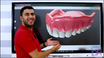 Removable Prosthodontics | First Term - التركيبات المتحركة | منهج الترم الأول الفرقة الأولى دفعة 2028