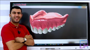 Preclinical Complete Denture 1 - كامل منهج الفرقة الأولى دفعة 2025