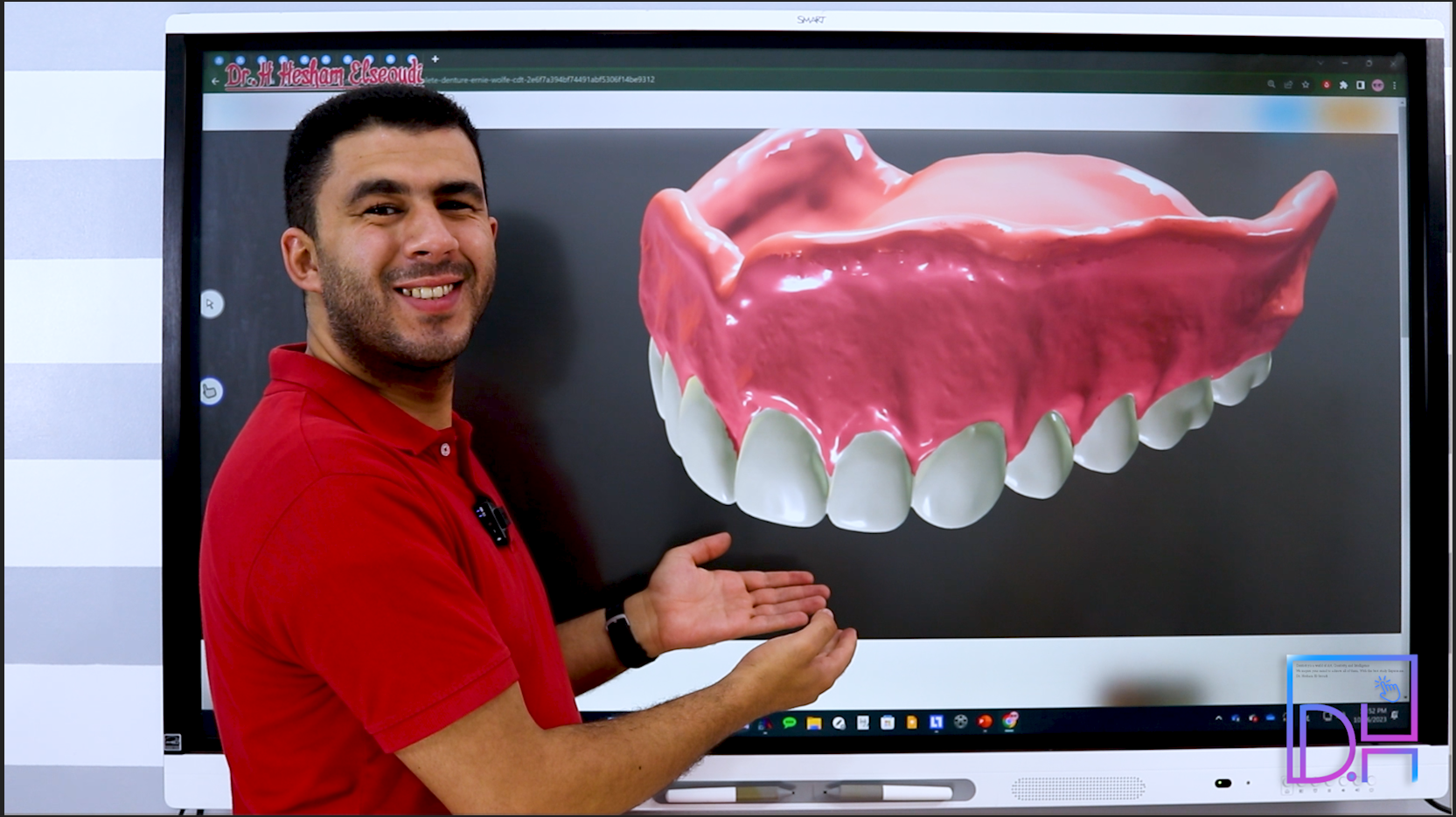 Complete Denture 1 ( Pre-Clinical )