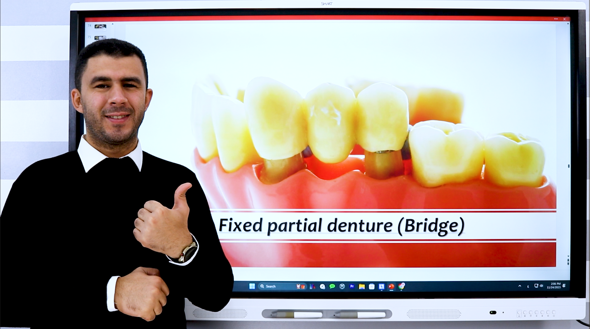 Fixed Prosthodontics - كامل منهج الفرقة الأولى دفعة 2027