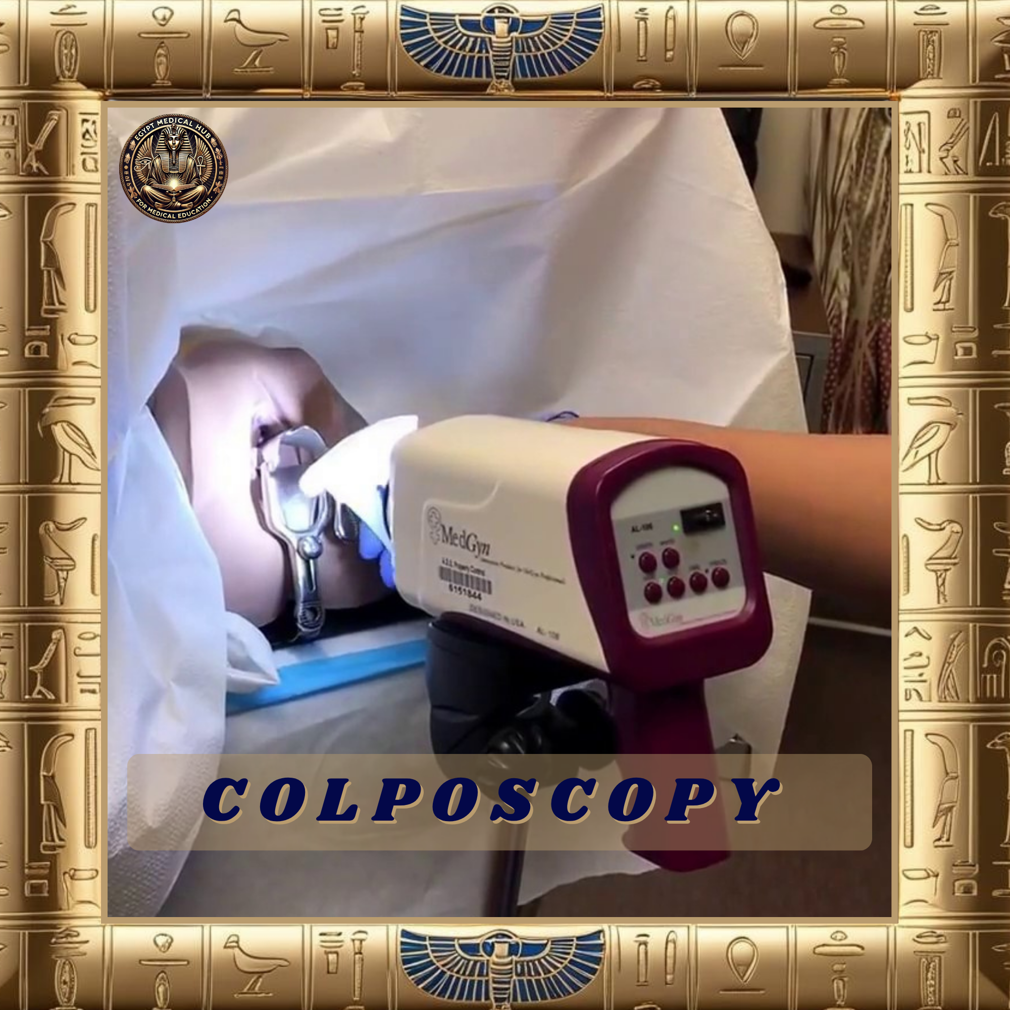 Colposcopy