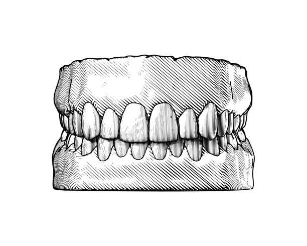 prothesis