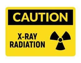 x ray