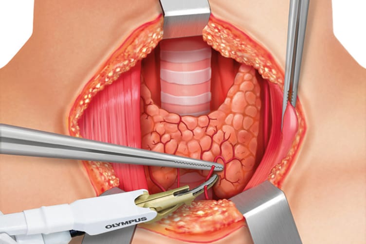 Glandular disorders - G -  Dr.Eslam Soliman