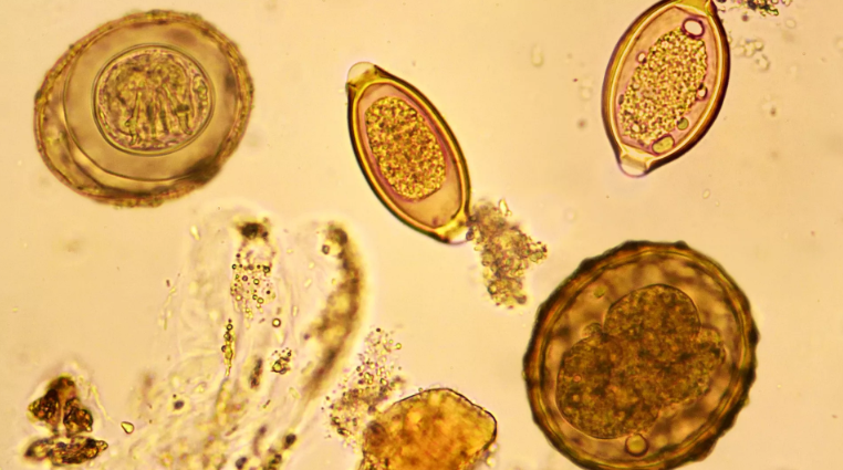 parasitology Disease Mechanism with Dr. MAHMOUD ALSHARAWY