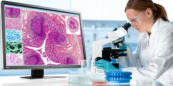 Practical Pathology DM By Dr.Mahmoud Zidan